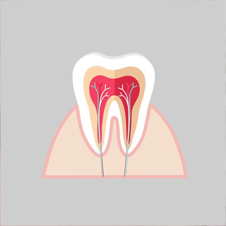 Root Canal Therapy